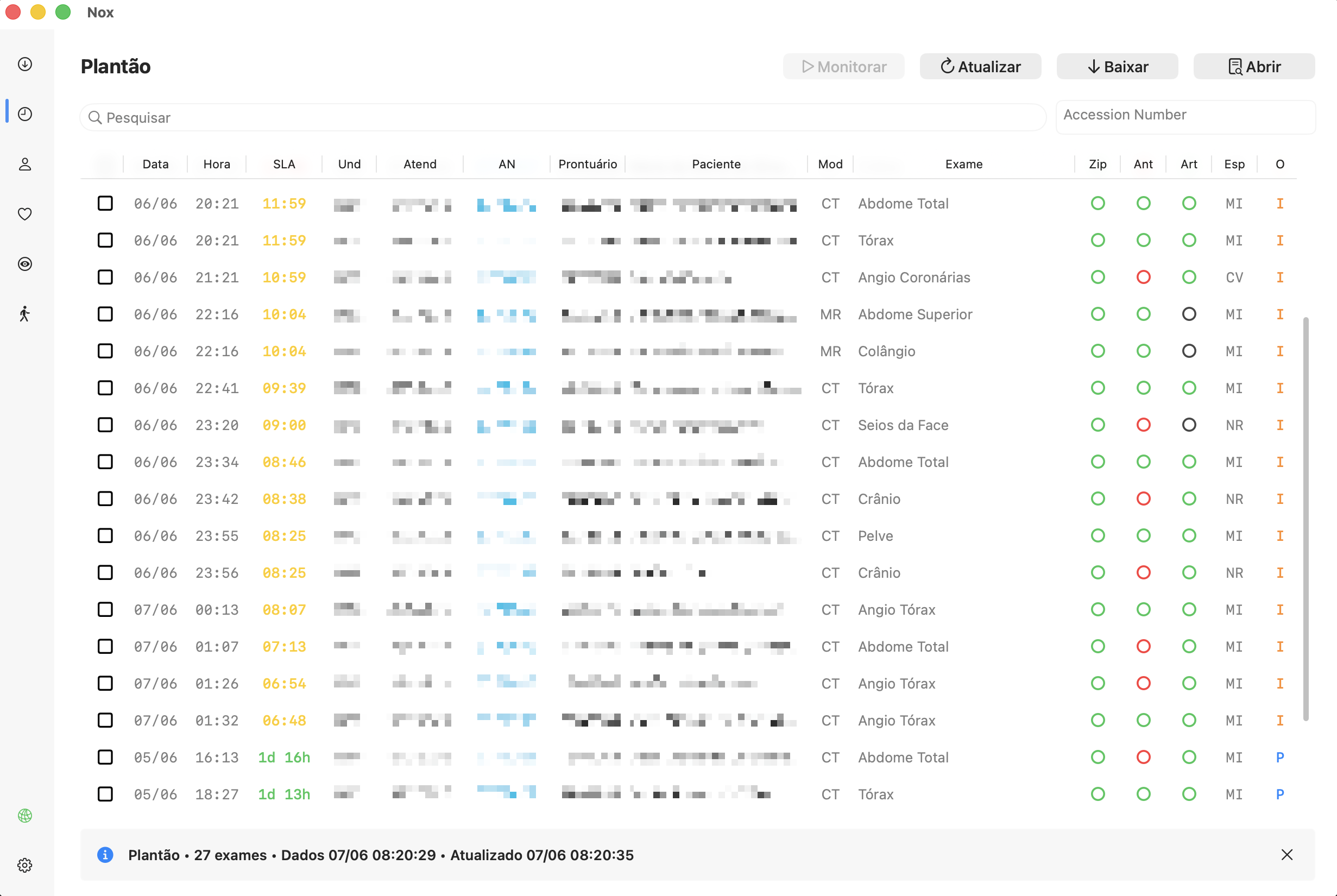 Interface macOS do Nox mostrando a fila Plantão, busca, botões de ação e colunas de disponibilidade Zip, Ant e Art.